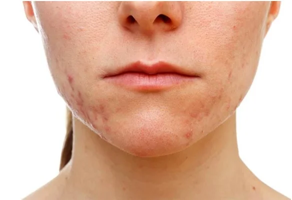 Dr. Naren Pandey, Allergy doctor in kolkata, allergy treatment